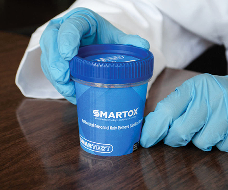 Smartox Urine Drug Testing